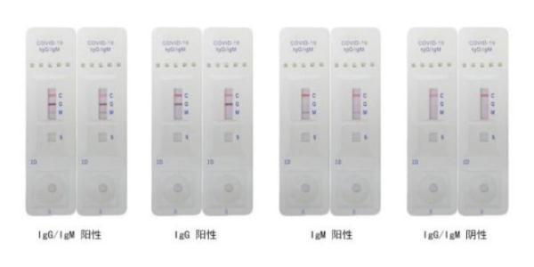 浙江最新抗体引领健康革命新篇章！
